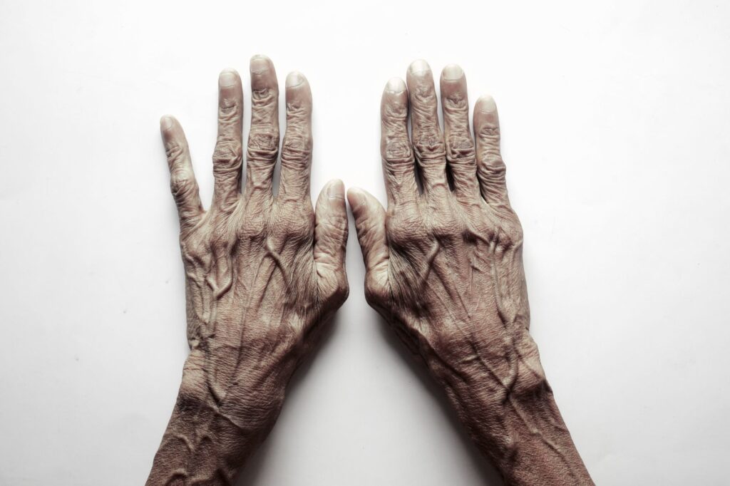 Top view of senior adult's hands on a white background, showcasing age and texture.
