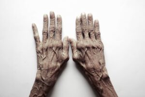 Top view of senior adult's hands on a white background, showcasing age and texture.