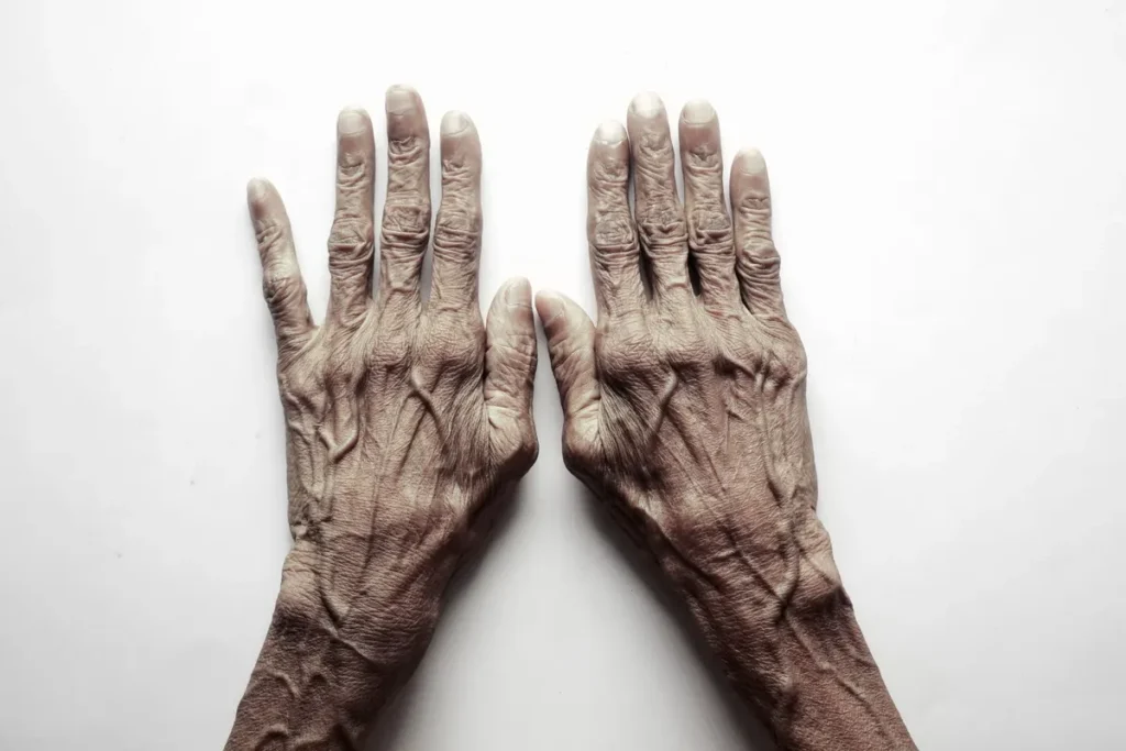 Top view of senior adult's hands on a white background, showcasing age and texture.